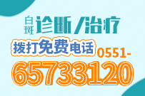 白斑怎么治、如何治白斑